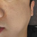 미인나라 | [광주 동구 피부관리] 쩍쩍 갈라지는 건조한 피부와 넓은 모공해결한 더미인나라 방문 후기(+주차) 💡