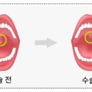 법인두그린