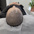 함께헤어 - 청주시 청원구 | 대구 두피 문신 뷰티콩드아카데미 | 삼촌과 함께 헤어스트록 상담받고 시술까지 받은 후기
