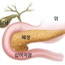 소화불량 너무 잦다면 췌장질환을 의심하라 이미지