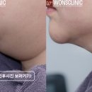 셀플러스의원 네이버블로그