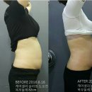 캡틴케어 네이버블로그