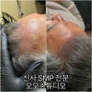「남(男)다른 그 신사의 하루」 | [신사 SMP] 오오스튜디오 | 신사두피관리 강남정수리커버 신사탈모관리 2회차 후기