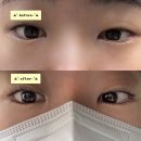 안양-안양-안양-506 | 안양 속눈썹펌 잘하는 곳 보니 속눈썹｜무쌍 눈매 맞춤 보니리프트래쉬 후기 ⋆. 𐙚 ˚