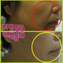 더예쁜피부관리실 이미지
