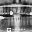 찬스플란트치과의원 이미지