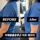 비포렉스 | 오리역 헬스장 어깨충돌증후군 비포 애프터 운동 후기 리뷰