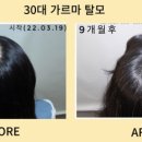 동명헤어라인 이미지