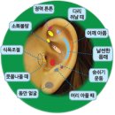 귀 건강학(이혈테라피) 이미지