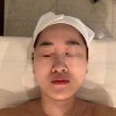 미즈고 피부미용 | 이대피부관리 여드름관리잘하는곳 미즈고데이스파 솔직후기