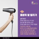 레푸스 경대점 이미지