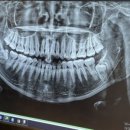 줌구강악안면외과치과의원 이미지