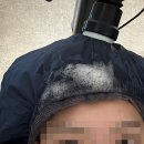 닥터모락 안성점 | 안성탈모성지 닥터모락 안성점 두피진단받고 데톡스케어