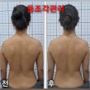 태전제일약국 | 칠곡 피부관리 더조각 어깨 안돌아가는 증상 대구 북구 등관리 추천 가인뷰티 에너지테라피 후기