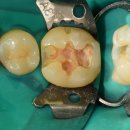 혁신척척의원 이미지