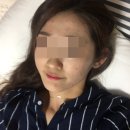 바르다한의원 | 성인여드름 원인 한의원 관리 병해 치료 후기