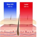 쓰리피테크(3PTech) | 피엘닥터 가정용 저출력 레이저 꼼꼼 후기