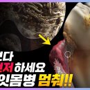 양치보다 매일 먼저 하면 잇몸병 사라지고 잇몸이 튼튼해져요 이미지