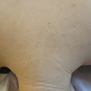 강서구-25 | 강서구 체형교정관리 후기 승모근,라운드숄더관리 1회차 솔직후기