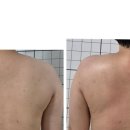 고운피부에스테틱 이미지