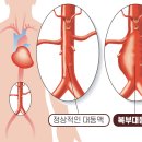 부풀다