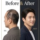헤어랩(hairLAB) | [탈모/맞춤가발] 가발 시술 업체 선택이 평생을 좌우한다?! 리커맨드헤어랩을 강력 추천하는 이유 💯