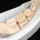 비욘드치과기공소 이미지