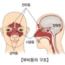 부비동염(Sinusitis)증상 이미지