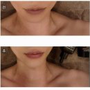 금수저 | 울산피부관리 울산윤곽관리 금수저에스테틱앤스파 솔직후기