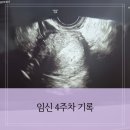 울산대학교병원 어린이집 | 둘째 임신 확인- 임신 4주차) 병원 방문, 임산부등록, 바우처 신청, 조리원 예약/출산예정일 계산하기