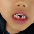 어린왕자치과 이미지
