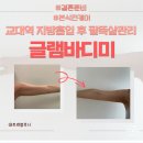 한림빌딩 | 교대역 지방흡입후관리 글램바디미｜본식 전 팔뚝살관리 셀룰리온 5일 변화 후기