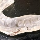 고요의원 | 이갈이 고요잠 마우스피스 가격의 비밀, 10배 아끼는 법