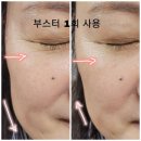 순천시 고형미생물 생산시설 | 요즘 핫한 '엑소리젠' 순천에서 가장 싸게 사는 법!