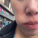 주식회사 바디채널 부평점 | 부평 예신 관리/브이 메디 스파에서 피부 광명 찾고 오기( 내 돈 내산 후기, 비포 애프터 o)