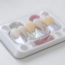 연세미래엔미소치과병원 | 드디어 나도 치아 미소를?! 연세 굿 플란트 방문 후기