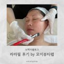 필 | 안 아픈데 예뻐진다고? 평택 모이뷰티랩 라라필 솔직후기 (광 미쳤음)