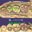 윤치과기공소 이미지