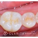 경진치과기공소 이미지