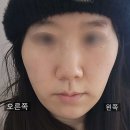 아름종합관리 | ※특집 [아름턱한의원] 2023년~2025년 2년동안 나름 빡세게 관리한 종합 후기! (+경락,스컬트라)