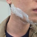 브이맨 | 브이맨달걀주사 20대남자 턱살 이중턱 제거 내돈내산