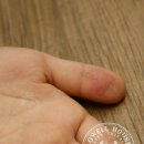 성현메디칼 이미지