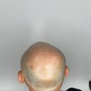 채도스칼프 이미지