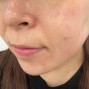 판암동144 | 대전동구피부관리 대전동구피부자격증 뷰마르 다녀오다