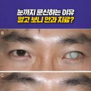 타투잉 TATTOOING 이미지