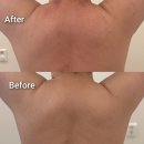 사하구 다대로 | 다대포피부관리 사하구 리움에스테틱 후기 | 지친 몸을 위한 편안한 힐링 케어