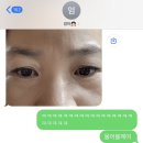 뷰티린이