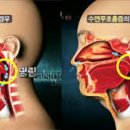 서울수면양압기센터 이미지