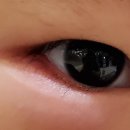 서초준안과의원 네이버블로그