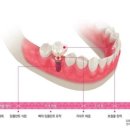 로덴치과의원(경성대,부경대점) 이미지